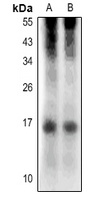 RNASE4 Rabbit Polyclonal Antibody