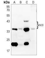 SCD Rabbit Polyclonal Antibody