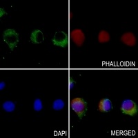 TBK1 Rabbit Polyclonal Antibody