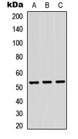 TRMT11 Rabbit Polyclonal Antibody