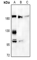 A2M Rabbit Polyclonal Antibody