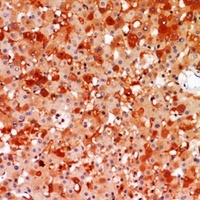 A2M Rabbit Polyclonal Antibody