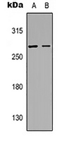 Aggrecan Rabbit Polyclonal Antibody