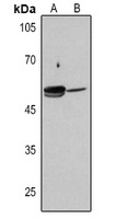 ALDH1A1 Rabbit Polyclonal Antibody