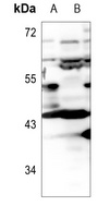 Apolipoprotein L1 Rabbit Polyclonal Antibody