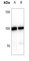 ATP6V0A2 Rabbit Polyclonal Antibody