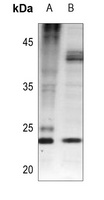 BAD (Phospho-S112) Rabbit Polyclonal Antibody