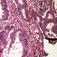 BAD (Phospho-S112) Rabbit Polyclonal Antibody