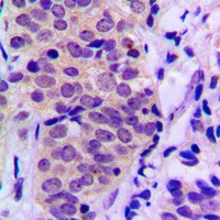 BAD (Phospho-S155) Rabbit Polyclonal Antibody