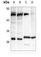BAP31 Rabbit Polyclonal Antibody