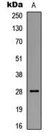 BCL2 (Phospho-S87) Rabbit Polyclonal Antibody