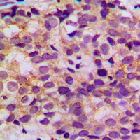 BCL2 (Phospho-S87) Rabbit Polyclonal Antibody