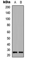 BIM (Phospho-S69) Antibody