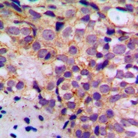 BIM (Phospho-S69) Antibody