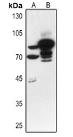 BCL6 Rabbit Polyclonal Antibody