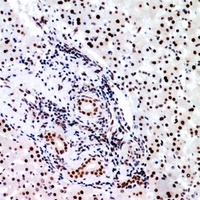 BCL6 Rabbit Polyclonal Antibody