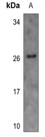 BinCARD Rabbit Polyclonal Antibody