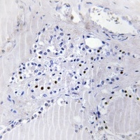BinCARD Rabbit Polyclonal Antibody
