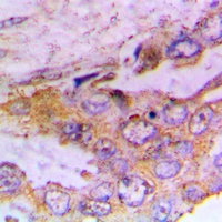 CaMK1 alpha (Phospho-T177) Rabbit Polyclonal Antibody