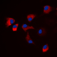 CaMK2 alpha/delta (Phospho-T286) Antibody
