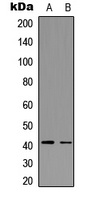 CCR5 (Phospho-S336) Antibody