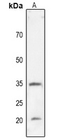 CD274 Rabbit Polyclonal Antibody
