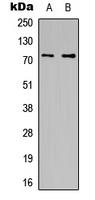 CDC16 Rabbit Polyclonal Antibody