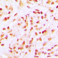 CDC16 Rabbit Polyclonal Antibody