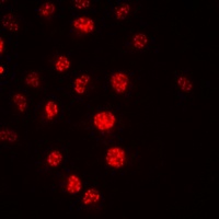 CDC16 Rabbit Polyclonal Antibody
