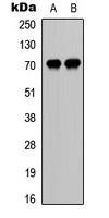 CDC25A (Phospho-S75) Rabbit Polyclonal Antibody