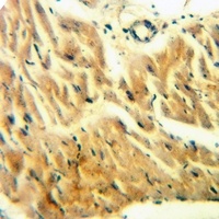 CDK2AP1 Rabbit Polyclonal Antibody