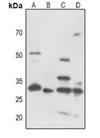 CDK5 (Phospho-Y15) Rabbit Polyclonal Antibody
