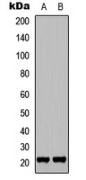 p21 (Phospho-T145) Antibody
