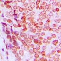 p21 (Phospho-T145) Rabbit Polyclonal Antibody