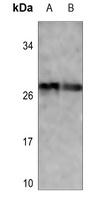 p27 Kip1 (Phospho-T187) Rabbit Polyclonal Antibody