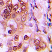 p27 Kip1 (Phospho-T187) Rabbit Polyclonal Antibody