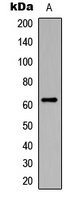 CHK2 (Phospho-S516) Rabbit Polyclonal Antibody
