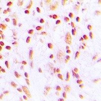 CHK2 (Phospho-T387) Rabbit Polyclonal Antibody