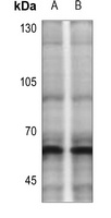 CHK2 (Phospho-T383) Rabbit Polyclonal Antibody