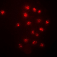 CHK2 (Phospho-T383) Rabbit Polyclonal Antibody