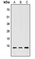 CHRAC1 Rabbit Polyclonal Antibody