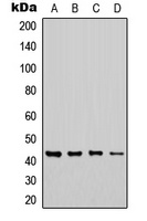 CHST6 Rabbit Polyclonal Antibody