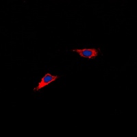 CHST6 Rabbit Polyclonal Antibody