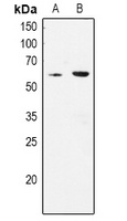 CLK1 Rabbit Polyclonal Antibody