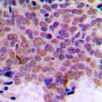 CLK1 Rabbit Polyclonal Antibody