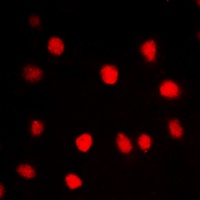 CLK1 Rabbit Polyclonal Antibody