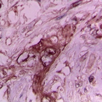 Collagen 2 alpha 1 Antibody