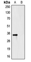 HSV-tag Antibody