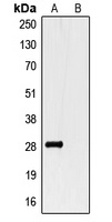 GST-tag Rabbit Polyclonal Antibody