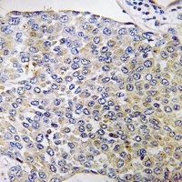 CPXM2 Rabbit Polyclonal Antibody